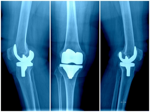 knee_joint